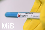 22.03.2020, Symbolbild Corona-Test, Positives Testergebnis. 