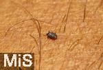 11.09.2024, Heimische Zecke sucht sich auf der menschlichen Haut eine Stelle zum Blut saugen.  Gemeiner Holzbock (Ixodes ricinus) 