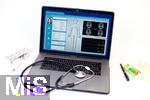 30.05.2025, Gesundheitswesen: elektronische Patientenakte auf dem Screen des Apple Laptops.