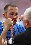 02.05.2026, Fussball Bundesliga 2025/2026, 32.Spieltag, FC Bayern München - 1.FC Heidenheim, in der Allianz-Arena München,   
Jonas Föhrenbach (1. FC Heidenheim 1846) blutet heftig


