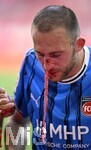 02.05.2026, Fussball Bundesliga 2025/2026, 32.Spieltag, FC Bayern München - 1.FC Heidenheim, in der Allianz-Arena München,   
Jonas Föhrenbach (1. FC Heidenheim 1846) blutet heftig

