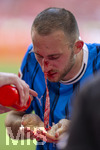02.05.2026, Fussball Bundesliga 2025/2026, 32.Spieltag, FC Bayern München - 1.FC Heidenheim, in der Allianz-Arena München, nach seinem Zusammenprall mit Torwart Diant Ramaj (FC Heidenheim) muss Jonas Föhrenbach (1. FC Heidenheim 1846) verletzt vom Platz, er blutet aus der gebrochenen Nase. Mit einer Mullbinde wird das Blut aus der Nase geholt.